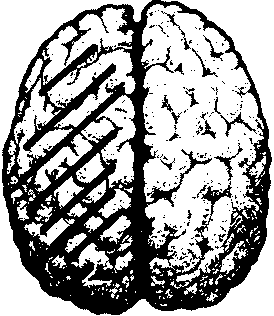 Местоположение на центъра за говор при мъжа Мозък със защриховано ляво полукълбо