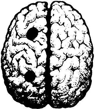 Местоположение на речниковия фонд при мъжа Мозък